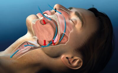 Snoring Isn’t the Only Problem: The Dangers of Sleep Apnea