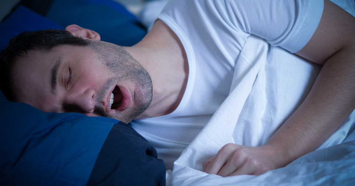 obstructive sleep apnea