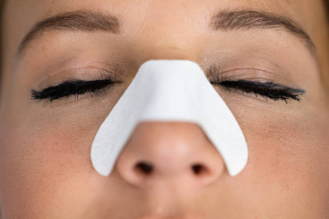 Woman wearing nasal strips on her nose to reduce snoring.