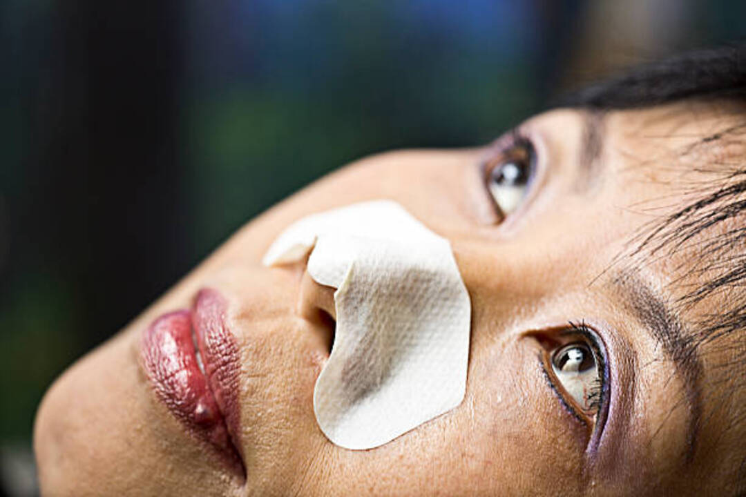 Close-up of woman wearing nasal strips on her nose.